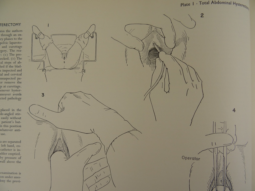 An atlas of pelvic operations 1953 - Afbeelding 13