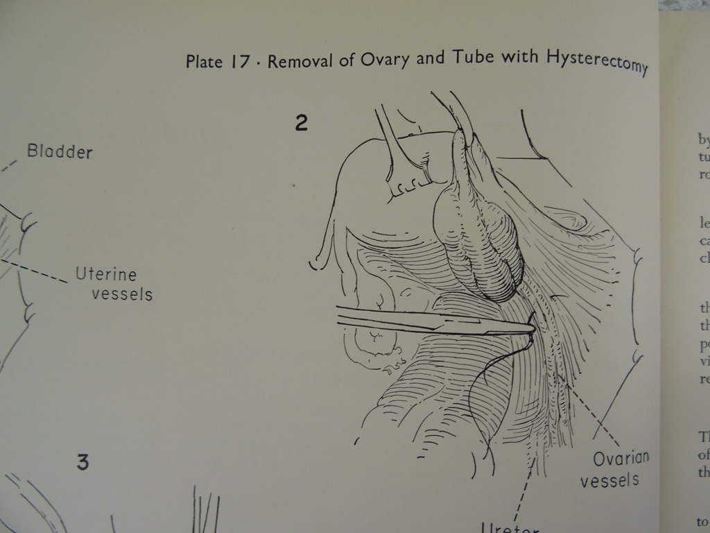 An atlas of pelvic operations 1953 - Afbeelding 14