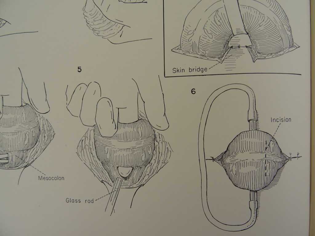 An atlas of pelvic operations 1953 - Afbeelding 15