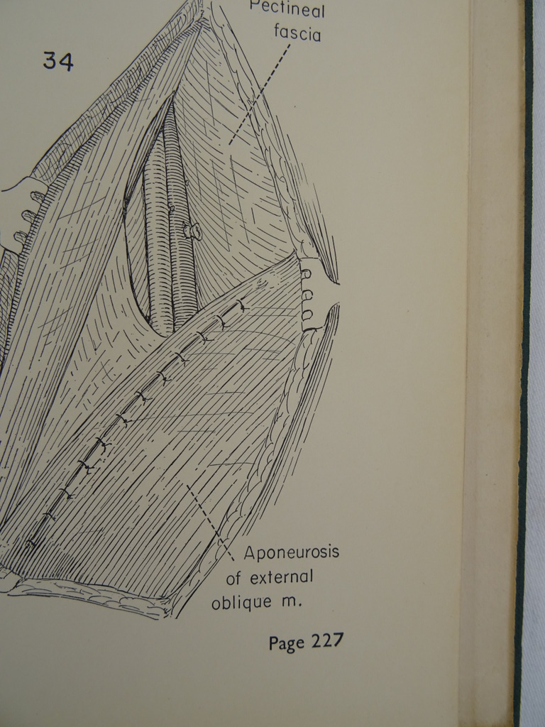 An atlas of pelvic operations 1953 - Afbeelding 17